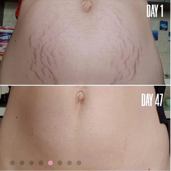 Maelys All Star Reshaping Bundle - Picture 6 of 7